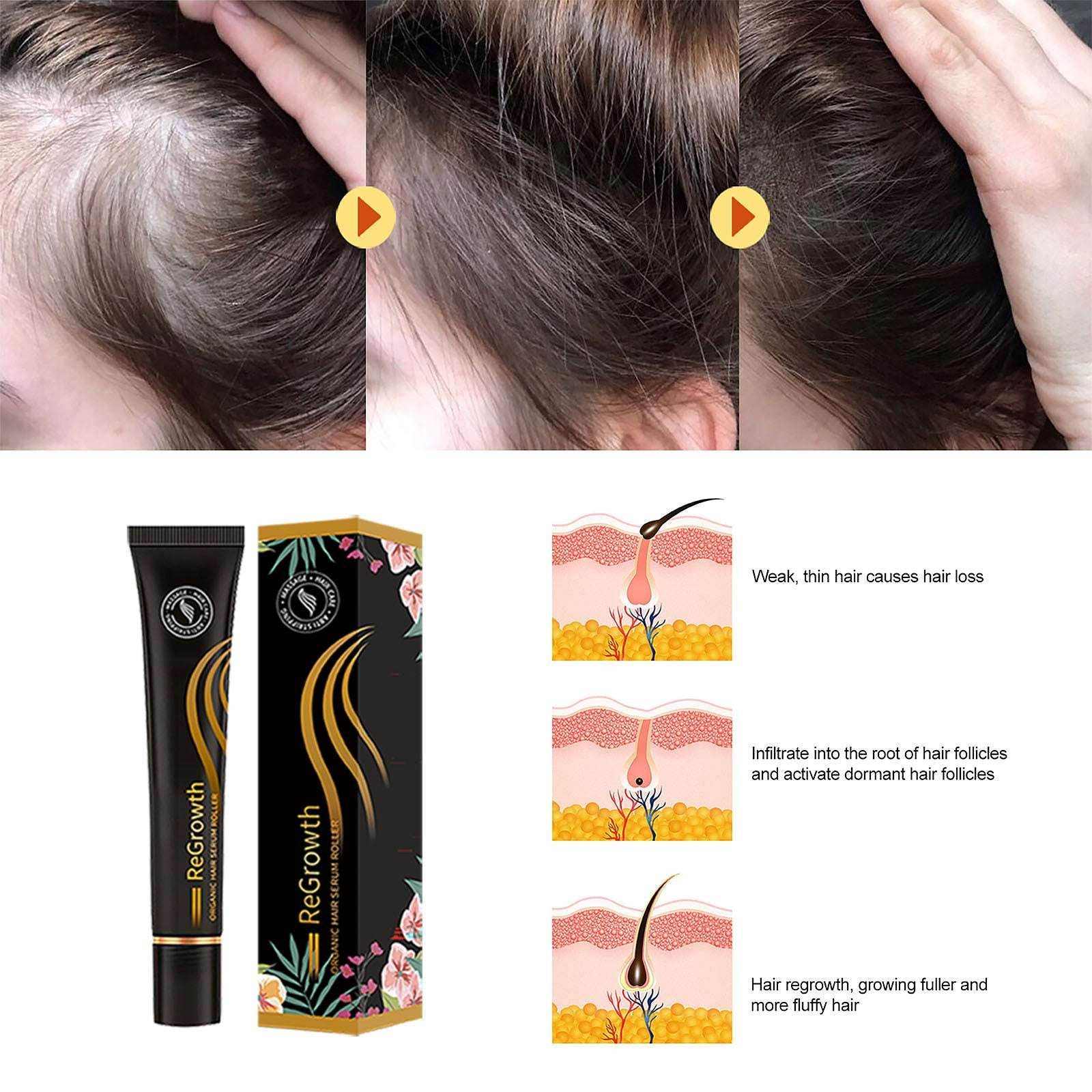 Organic Hair Regrowth Serum Roller Set - Natural Treatment