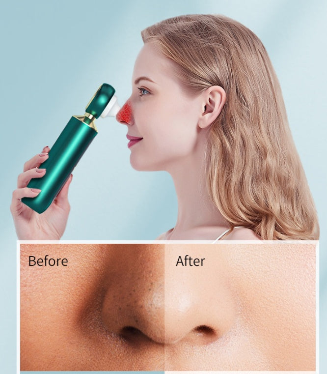 Portable visual blackhead meter magnifying glass for clear skin analysis