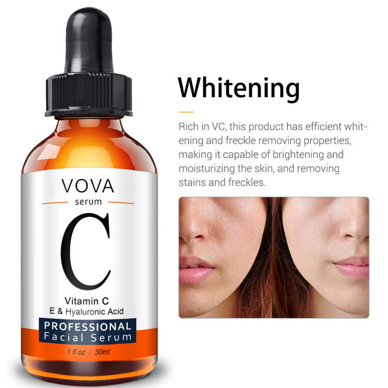 Vitamin C Serum Facial Serum Amazon: Brightening and moisturizing serum with efficient whitening and freckle removing properties for radiant skin